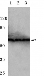 AP06489PU-N - AKT1 / PKB