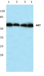 AP06490PU-N - AKT1 / PKB