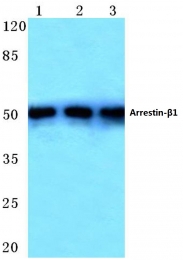 AP06496PU-N - Arrestin beta-1 / ARRB1