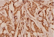 AP06508PU-N - CD88 / C5R1