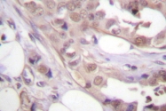 AP06510PU-N - CDK7