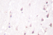 AP06514PU-N - AP-1 / c-Jun