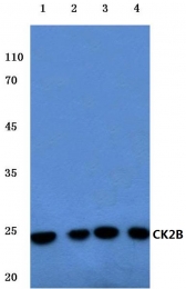 AP06515PU-N - Casein kinase II beta