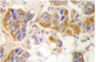 AP06516PU-N - Collagen type I alpha 2 chain