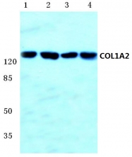 AP06516PU-N - Collagen type I alpha 2 chain