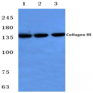 AP06517PU-N - Collagen type III alpha 1 chain