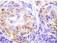 AP06517PU-N - Collagen type III alpha 1 chain