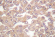 AP06518PU-N - CD115