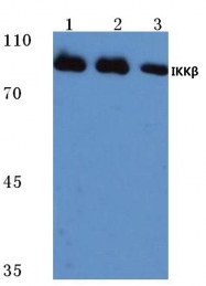 AP06526PU-N - IKBKB / IKKB