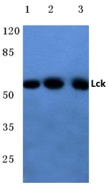 AP06534PU-N - LCK