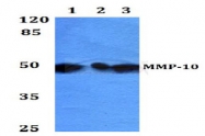 AP06537PU-N - MMP-10
