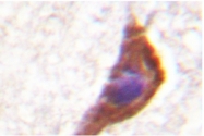 AP06547PU-N - NMDA Receptor 1
