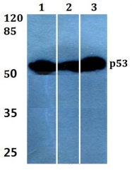 AP06550PU-N - TP53 / p53