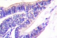 AP06553PU-N - RPS6KB1 / STK14A