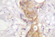 AP06564PU-N - PRKCD