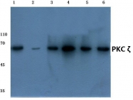 AP06565PU-N - PRKCZ