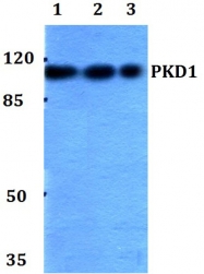 AP06569PU-N - PRKD1