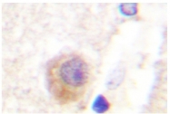AP06576PU-N - Rabphilin-3A / RPH3A