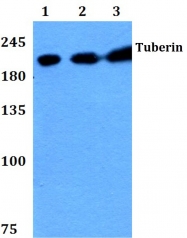 AP06590PU-N - Tuberin / TSC2