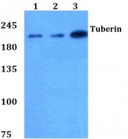 AP06591PU-N - Tuberin / TSC2