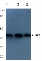 AP06597PU-N - Aurora kinase B