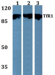 AP06598PU-N - CD71 / TFRC