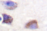 AP06601PU-N - FAK1 / PTK2