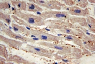 AP06606PU-N - YAP1