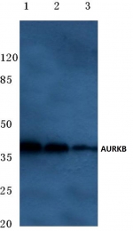 AP06609PU-N - Aurora kinase B