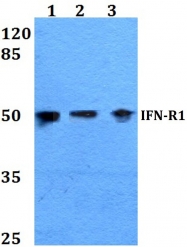 AP06615PU-N - IFNAR1