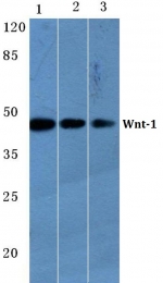 AP06617PU-N - WNT1