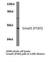 AP06624PU-N - SMAD1