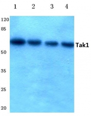 AP06625PU-N - TAK1 / MAP3K7