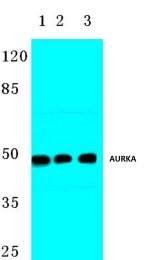 AP06626PU-N - Aurora kinase A