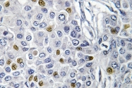 AP06626PU-N - Aurora kinase A