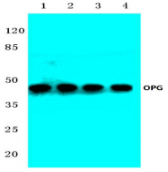 AP06631PU-N - Osteoprotegerin / TNFRSF11B