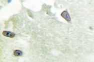 AP06632PU-N - DLGAP1 / SAPAP1