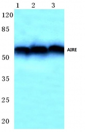 AP06638PU-N - AIRE / APECED