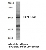 AP06640PU-N - HBP1