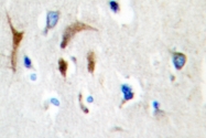 AP06640PU-N - HBP1