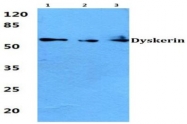 AP06643PU-N - DKC1 / NOLA4