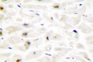 AP06660PU-N - HOXC6 / HOX3C