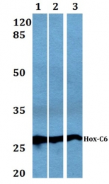AP06660PU-N - HOXC6 / HOX3C