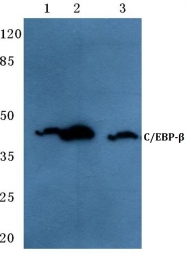 AP06676PU-N - CEBPB