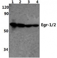 AP06678PU-N - EGR1