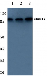 AP06683PU-N - Catenin beta-1