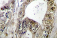 AP06685PU-N - HNF1 alpha / TCF1