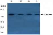 AP06686PU-N - Activin receptor type 1B / ACVR1B