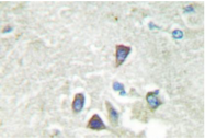 AP06686PU-N - Activin receptor type 1B / ACVR1B