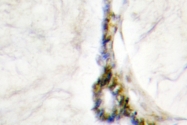 AP06689PU-N - HNF4 alpha / TCF14